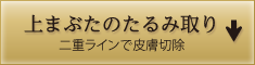 上まぶたのたるみ取り/二重ラインで皮膚切除