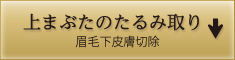 上まぶたのたるみ取り/眉毛下皮膚切除