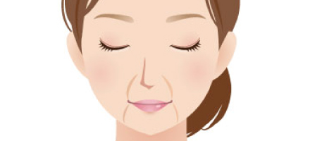 法令線、マリオネットライン