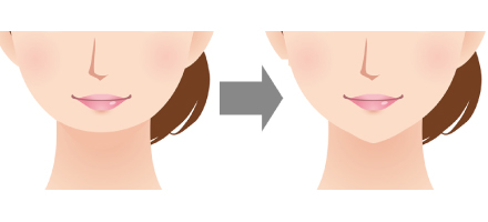 あごをシャープにする