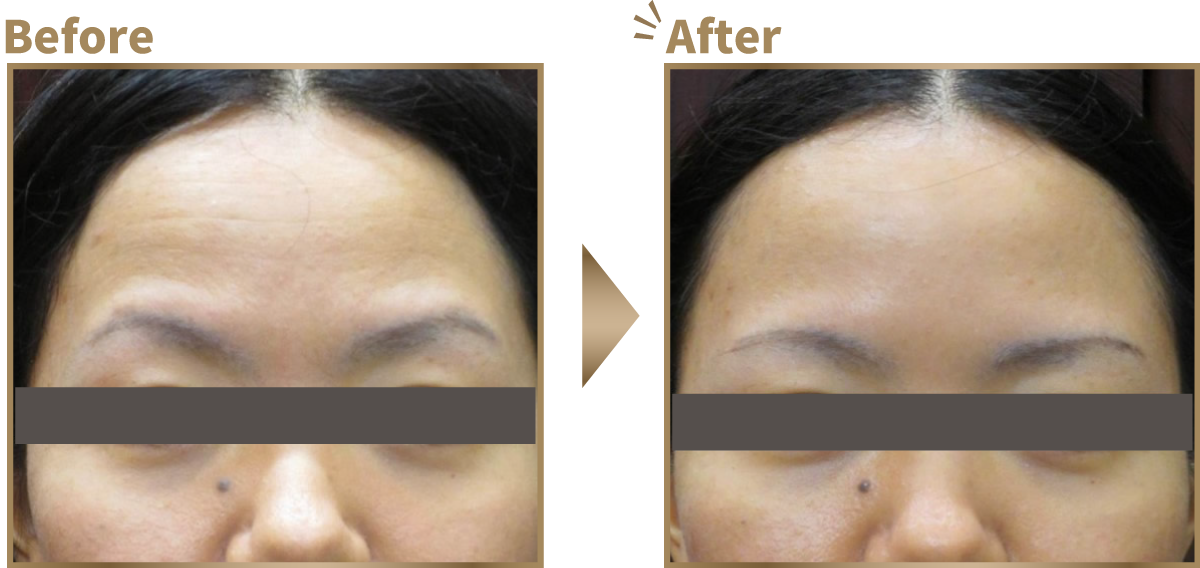 リラックスした状態 ビフォーアフター