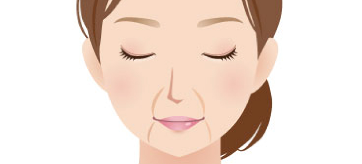 法令線、マリオネットライン