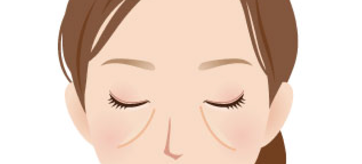 目の下のくま・たるみ（ミッドチークライン・ゴルゴライン）