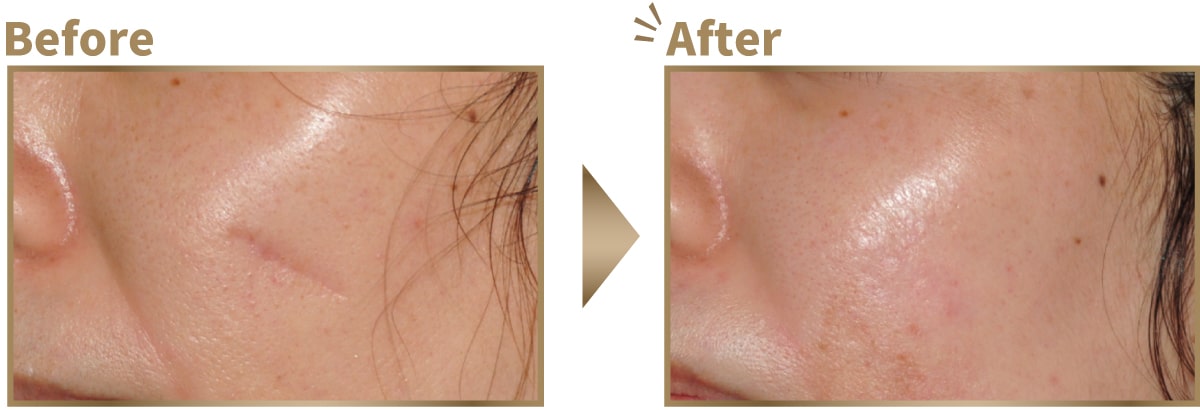 症例写真ビフォーアフター