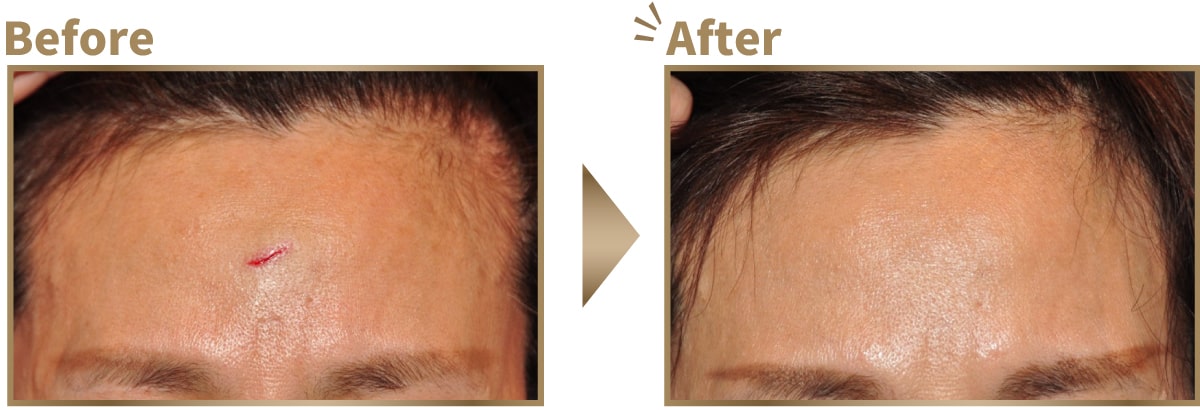 症例写真ビフォーアフター