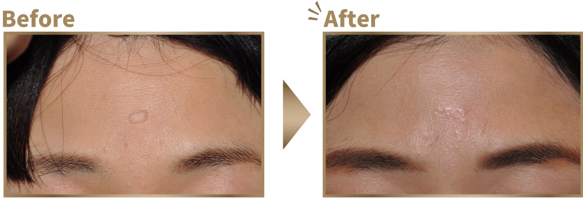 症例写真ビフォーアフター