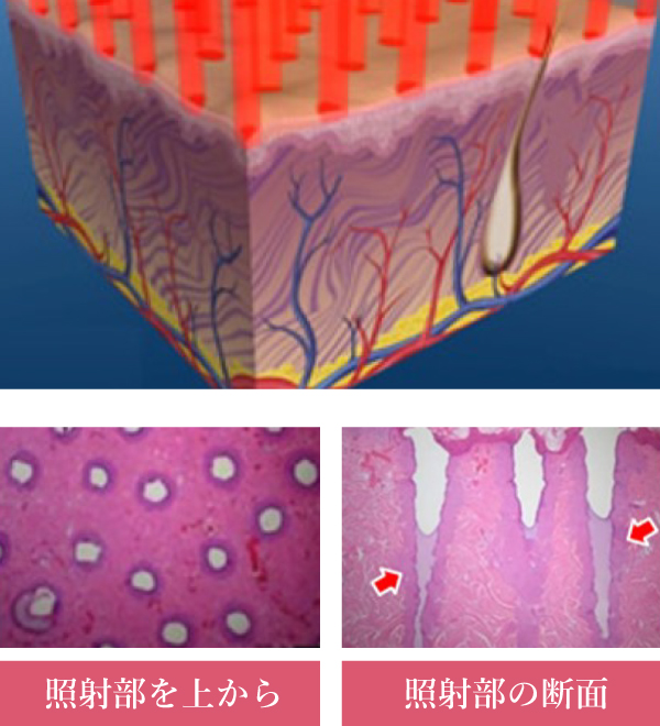 肌再生イメージ