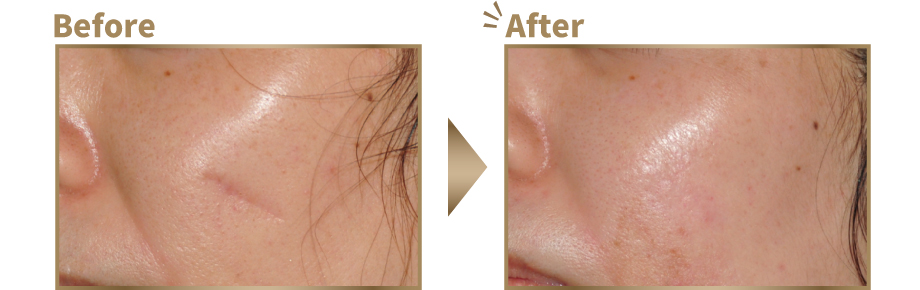 症例写真ビフォーアフター