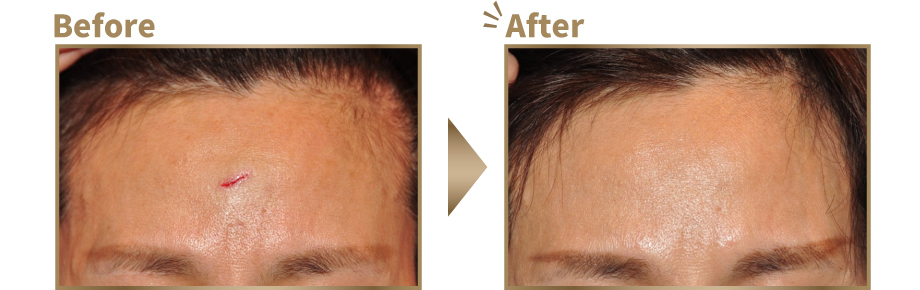 症例写真ビフォーアフター