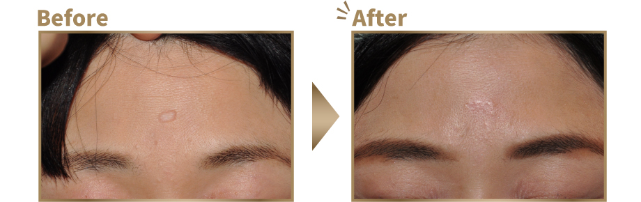 症例写真ビフォーアフター