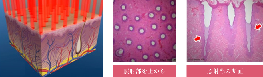 肌再生イメージ